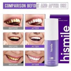 خمیر دندان سفید کننده و جرم گیر فوری های اسمایل مدل hismile v34 حجم 30 میلی لیتر