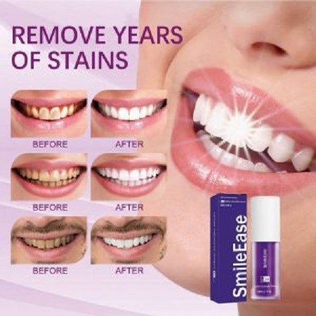 خمیر دندان سفید کننده و جرم گیر فوری های اسمایل مدل hismile v34 حجم 30 میلی لیتر